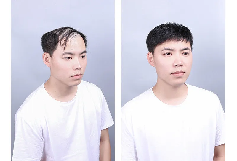 Men's Hair Replacement Forehead Bald Flip Cover