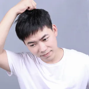 Men's Hair Replacement Forehead Bald Flip Cover