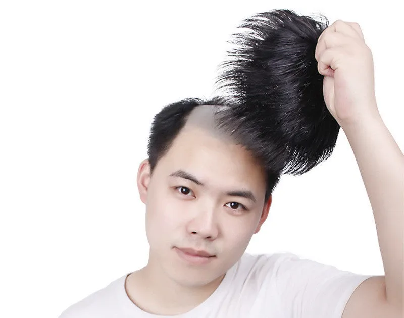 Men's Hair Replacement Forehead Bald Flip Cover